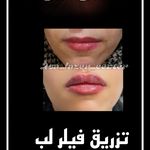 مرکزکلینیک لیزر زیبایی پوست و مو آسا