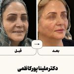 مطب  دکتر ملینا پورکاظمی
