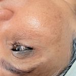 سالن تخصصی پاکسازی پوست هما