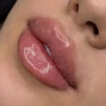 مطب پوست، مو و زیبایی و لیزر شبیرا