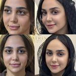 کلینیک زیبایی کاترین