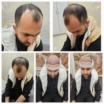 کلینیک زیبایی پوست و مو آتریسا