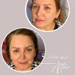 کلینیک لیزر وزیبایی پوست ومو آیشیل