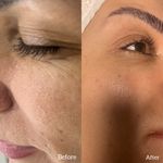 فیشال (مراقبت پوست)