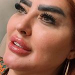 مطب پوست،مو ، زیبایی ولیزر