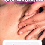 فشیال و اسکالپ زن روز