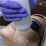 فشیال و اسکالپ زن روز
