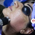 فشیال و اسکالپ زن روز