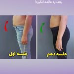 مرکز لاغری دمور