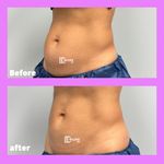 مرکز لاغری دمور