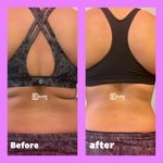 مرکز لاغری دمور