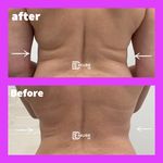 مرکز لاغری دمور