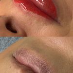 میکروکیماسی( میکروابرو چشم لب،ریمو)