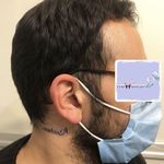 شنوایی سنجی و سمعک نیوساند