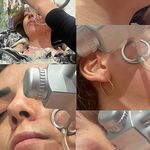 کلینیک زیبایی و لاغری آپیلنس