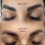 کلینیک تخصصی حذف تاتو