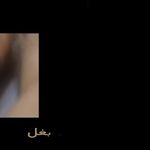 کلینیک زیبایی و لیزر الماس زیبایی