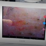 خدمات تخصصی فیشیال مهسا پورنجف
