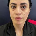 مرکز پوست، مو، زیبایی و لیزر هُلو