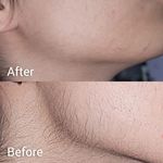 فیشال تخصصی مهبان اسکین کر