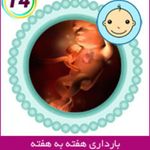 تصویربرداری سونوگرافی سیتی اسکن سایه