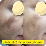 کلینیک پوست و مو زیبایی اُکتا - کرج - 7334
