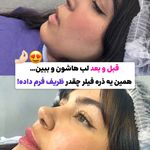 مرکز لیزر،پوست،مو و زیبایی سرو مهر