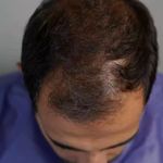 کاشت تخصصی مو فول کاشت گیلان