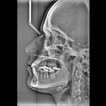 فتوگرافی پزشکی مظلومی