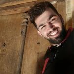 کاشت مو سر و ریش و ابرو بقایی