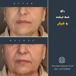 کلینیک پوست و مو موتاکس ملکی