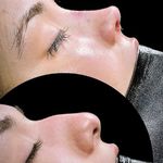 جراحی بینی غزل گودرزی