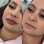 کلینیک پوست،مو،زیبایی،مرکز لیزر ‌پرنسا