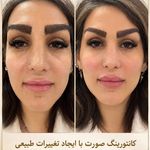 کلینیک پوست،مو،زیبایی و لیزر دالیا