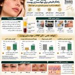 مرکز پی آر پی تهران