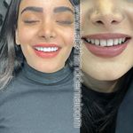 دندانپزشکی دکتر مصطفی محمدی-بیمه نداریم