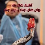 دندانپزشکی دکتر مصطفی محمدی-بیمه نداریم