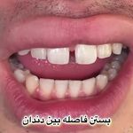 دندانپزشکی دکتر مصطفی محمدی-بیمه نداریم