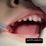دندانپزشکی دکتر مصطفی محمدی-بیمه نداریم