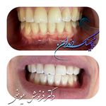 مركز دندانپزشکی دکترفرنوش عیوضی