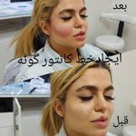 کلینیک پوست و مو و لیزر نیلوفر آبی