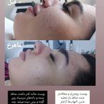 سالن زیبایی الهه ی قاسمی