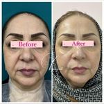 مرکز لیزر و کلینیک پوست و زیبایی نلا