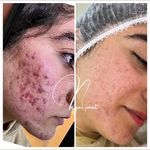 مرکز لیزر و کلینیک پوست و زیبایی نلا