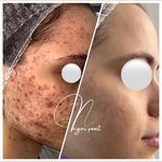 مرکز لیزر و کلینیک پوست و زیبایی نلا