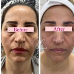 مرکز لیزر و کلینیک پوست و زیبایی نلا