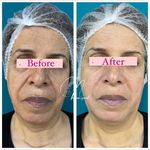 مرکز لیزر و کلینیک پوست و زیبایی نلا