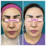 مرکز لیزر و کلینیک پوست و زیبایی نلا