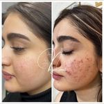 مرکز لیزر و کلینیک پوست و زیبایی نلا