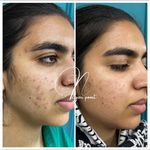 مرکز لیزر و کلینیک پوست و زیبایی نلا